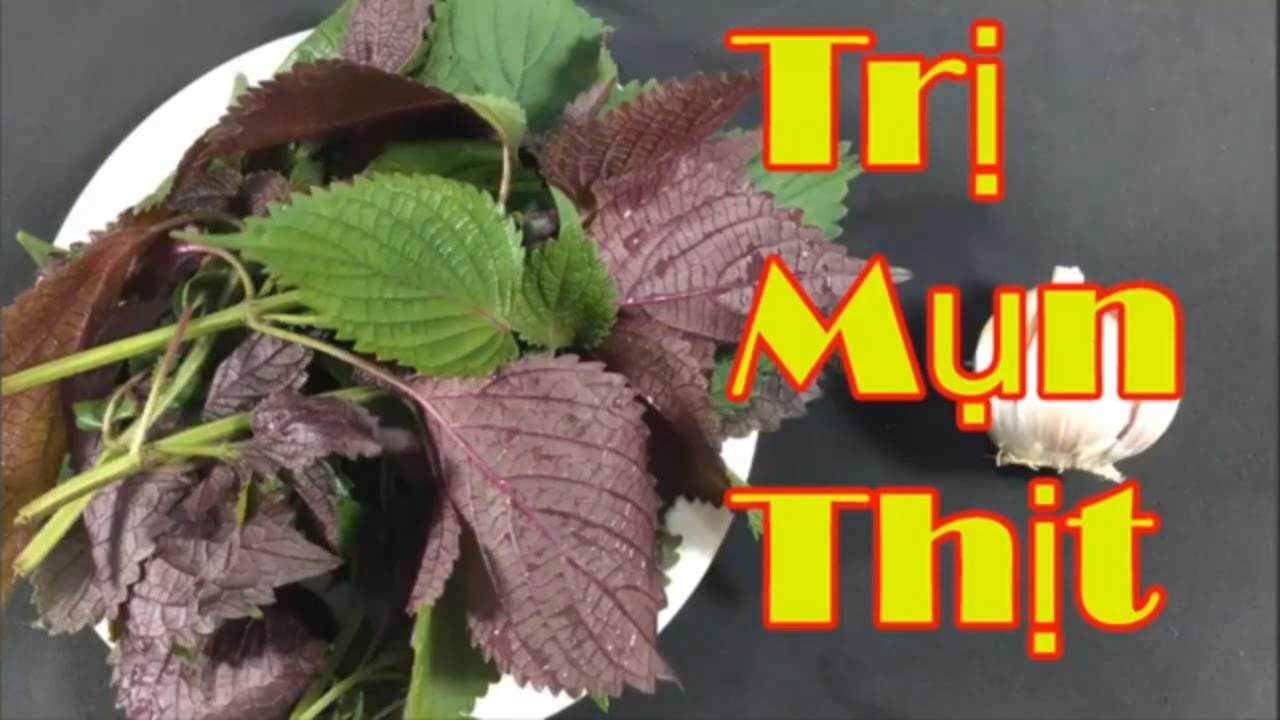 Cách trị mụn thịt bằng lá tía tô cho bạn hiệu quả bất ngờ [Sức khỏe]