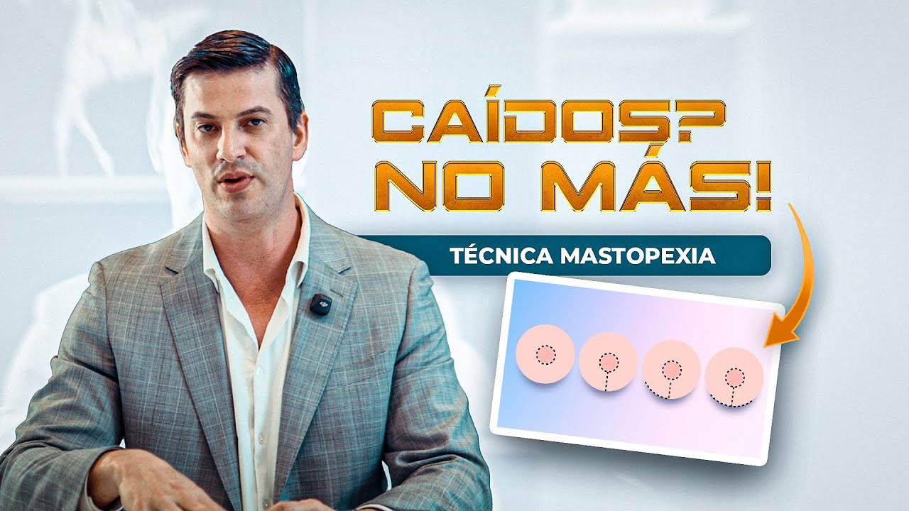 Mastopexia: el secreto para levantar y rejuvenecer el busto (casos reales)