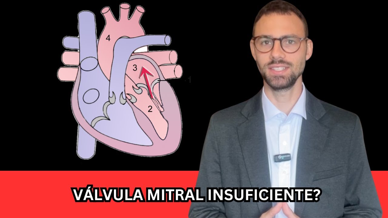 Insuficiência da Válvula Mitral: O que você deve saber!
