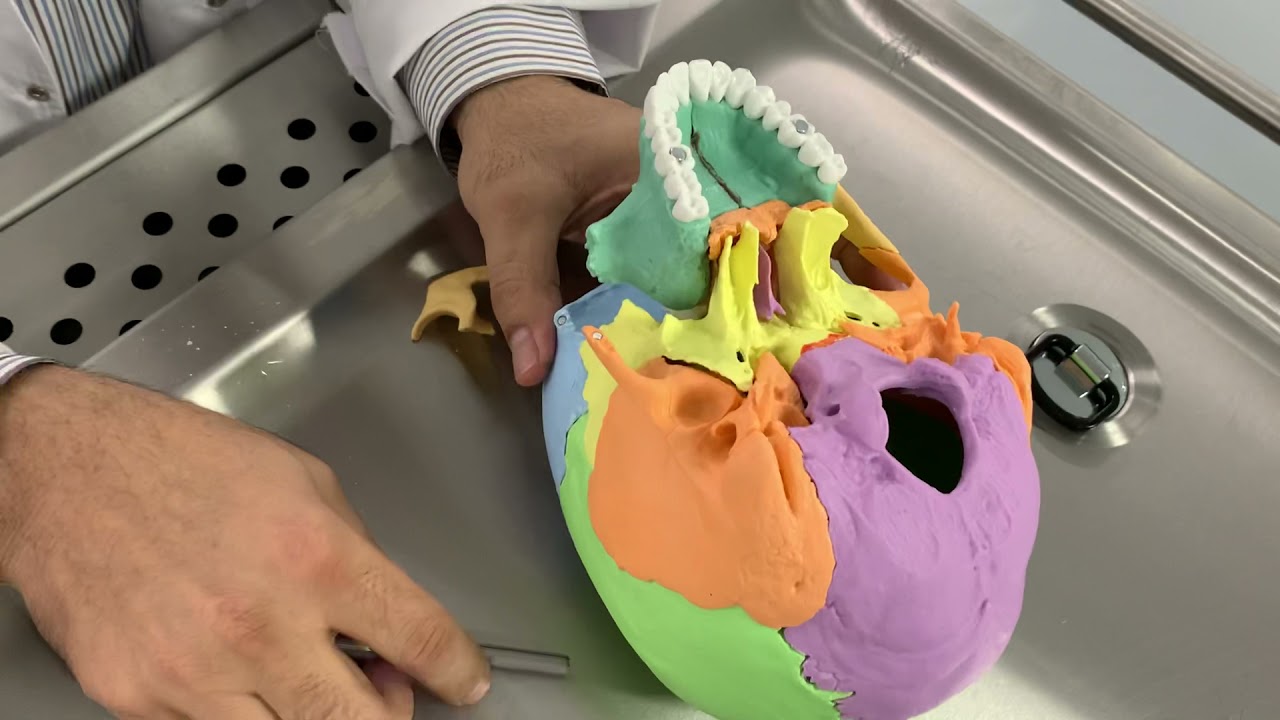 Skull general revision (foundation A)