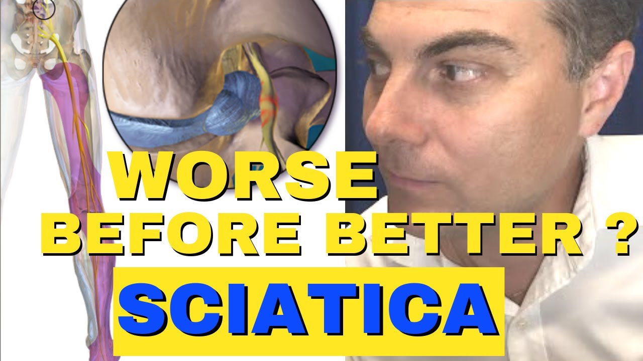 Does Sciatica Get Worse Before It Gets Better❓ About Sciatica Pain Relief