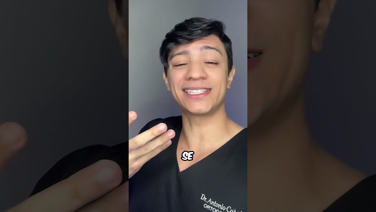 Fiz clareamento dental sozinho em casa! 🦷😯 #shorts #clareamentodental
