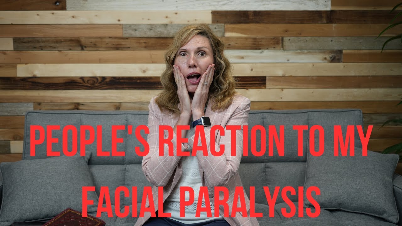 The Different Ways People React When They See Your Face Is Paralyzed