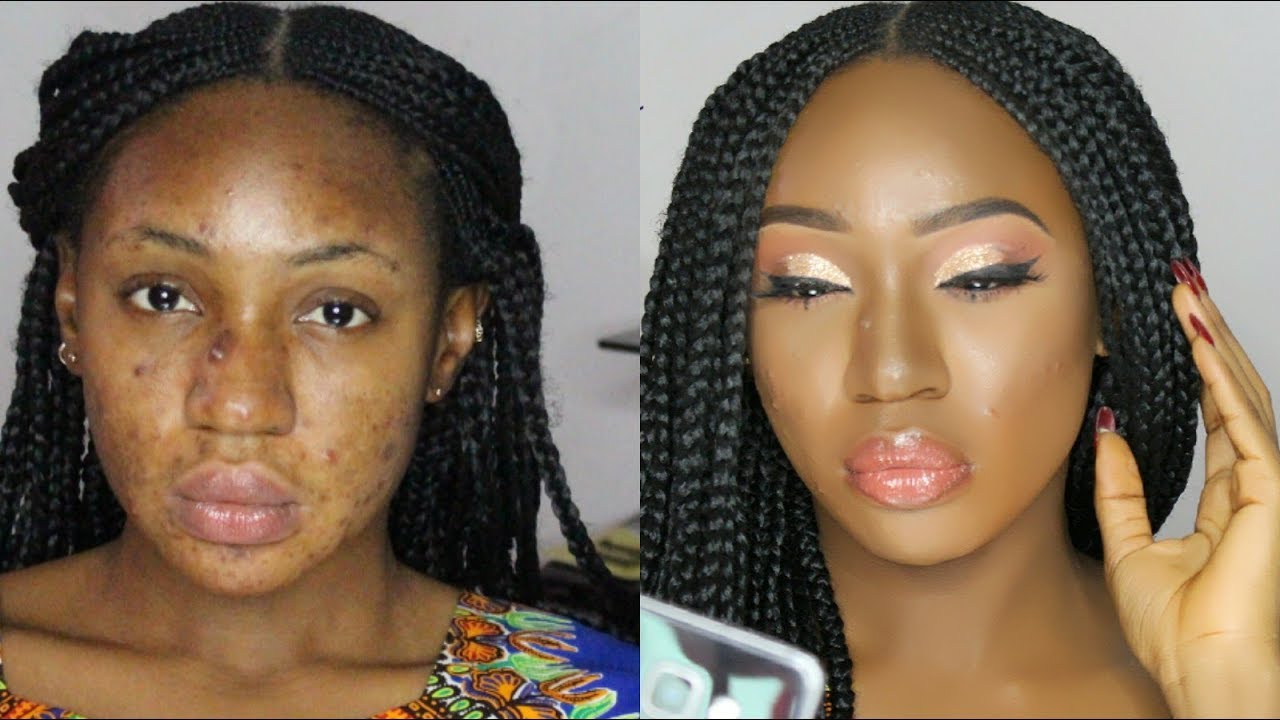 How To Cover Acne Scars. Makeup Tutorial