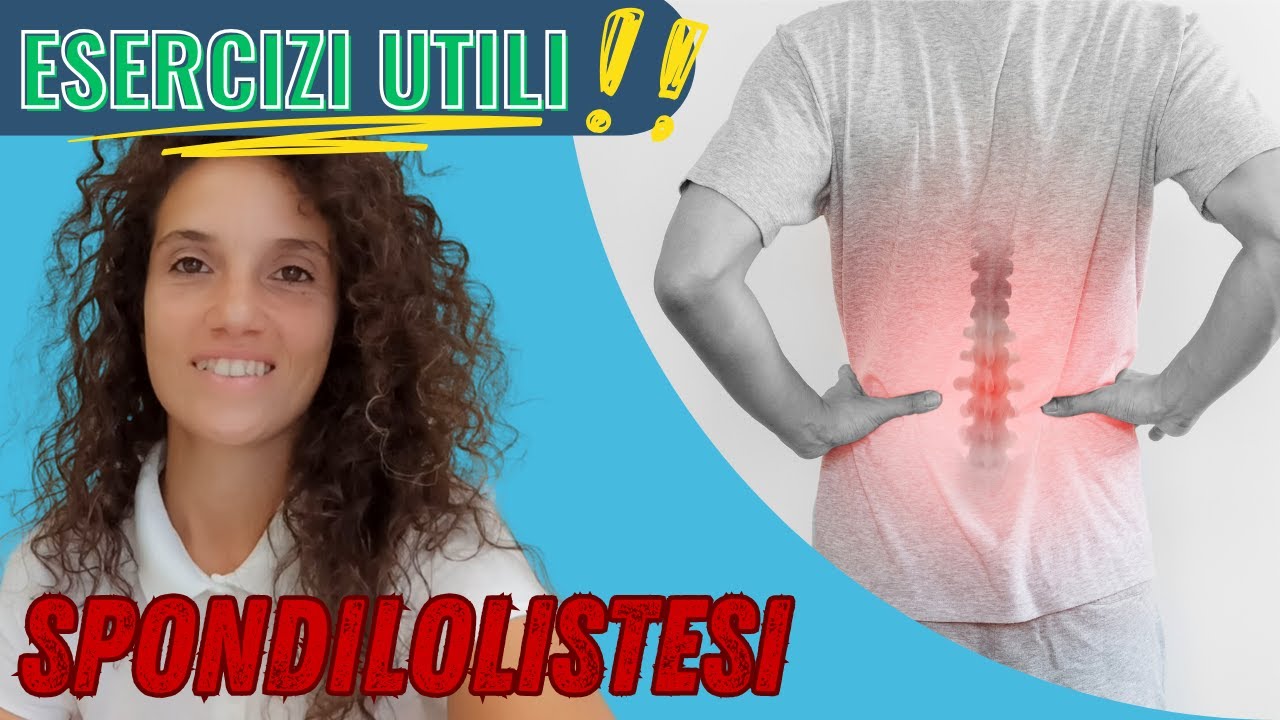 ✅ SPONDILOLISTESI: i migliori esercizi