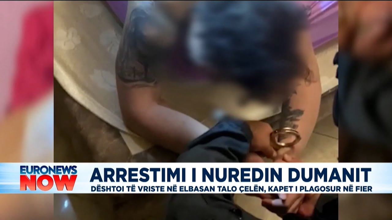 Arrestimi i Nuredin Dumanit: D&euml;shtoi t&euml; vriste n&euml; Elbasan Talo &Ccedil;el&euml;n, kapet i plagosur n&euml; Fier
