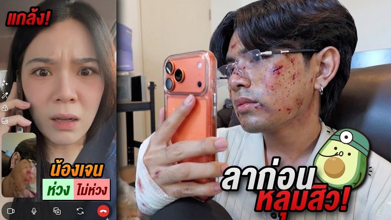 โมโตรถล้ม! งานนี้เสียโฉมไหม? จะมีใครเป็นห่วงบ้าง?