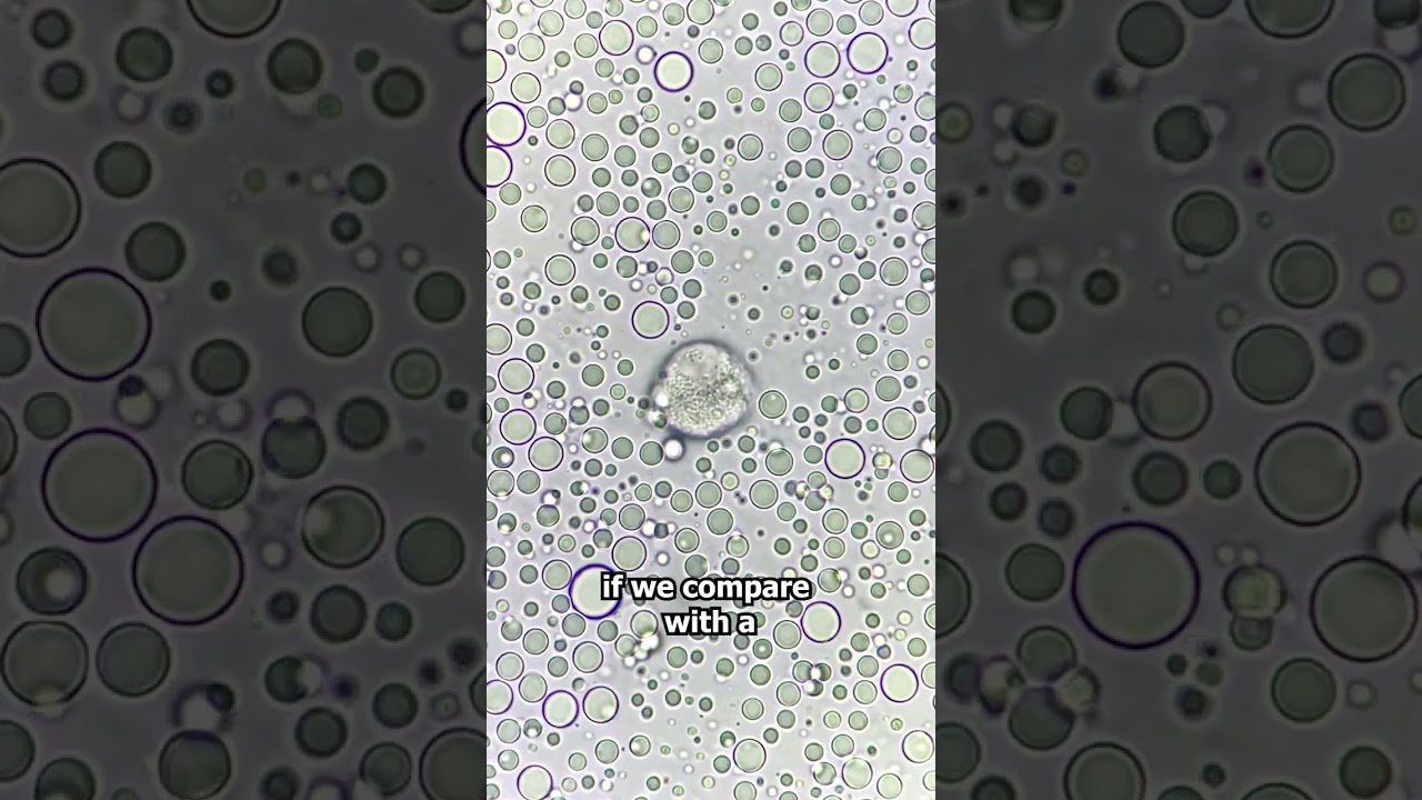 Raw Cows Milk VS Human Breast Milk under the microscope!