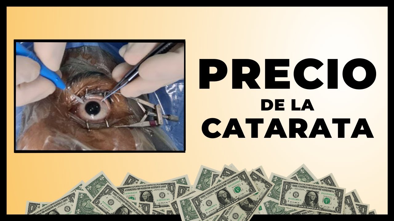 💲COSTO de Cirugía de Cataratas ? | Conoce el motivo # 1 que AUMENTA el PRECIO [Parte 2]