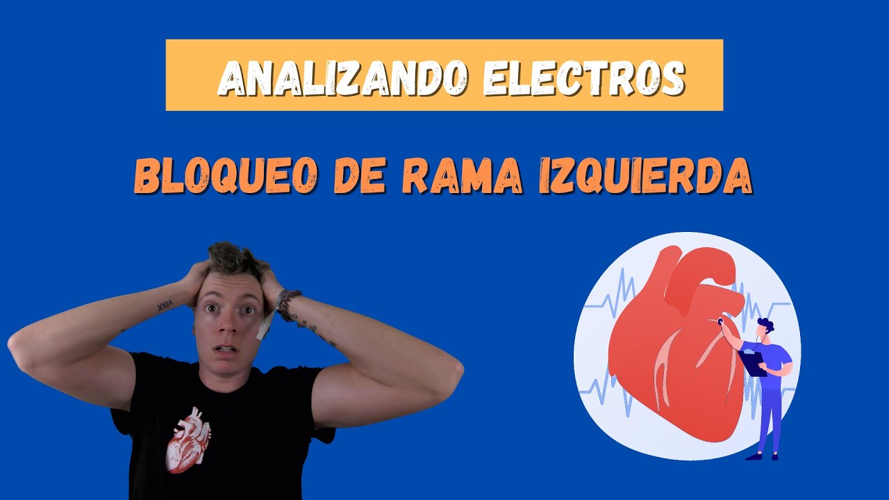 📍ANALIZANDO ELECTROS: Bloqueo de rama izquierda #mir #mir23