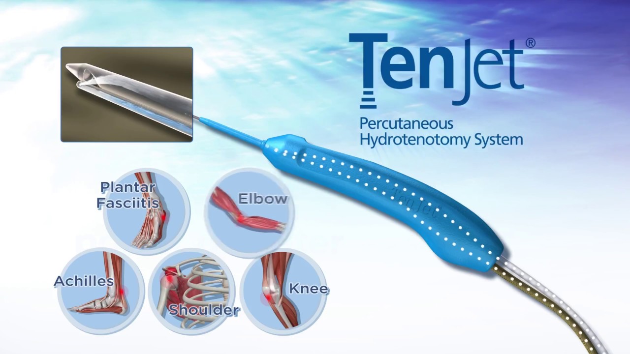 TenJet for Tenotomy Demonstration