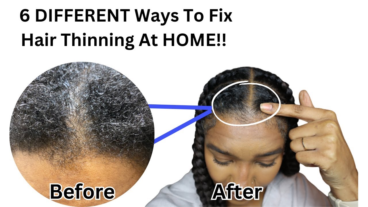 Is Your Natural Hair THINNING?- (6 Ways To Fix This) !