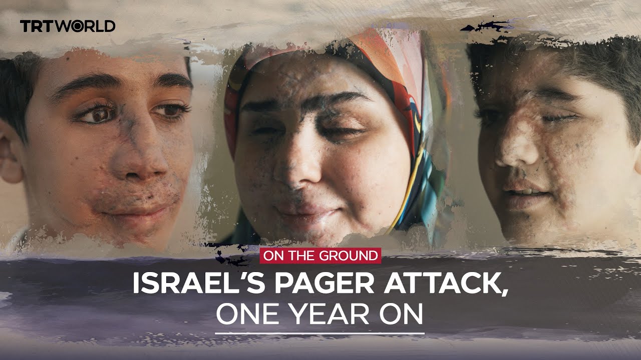 Marked for life: A year after Israel’s pager attack on Lebanon