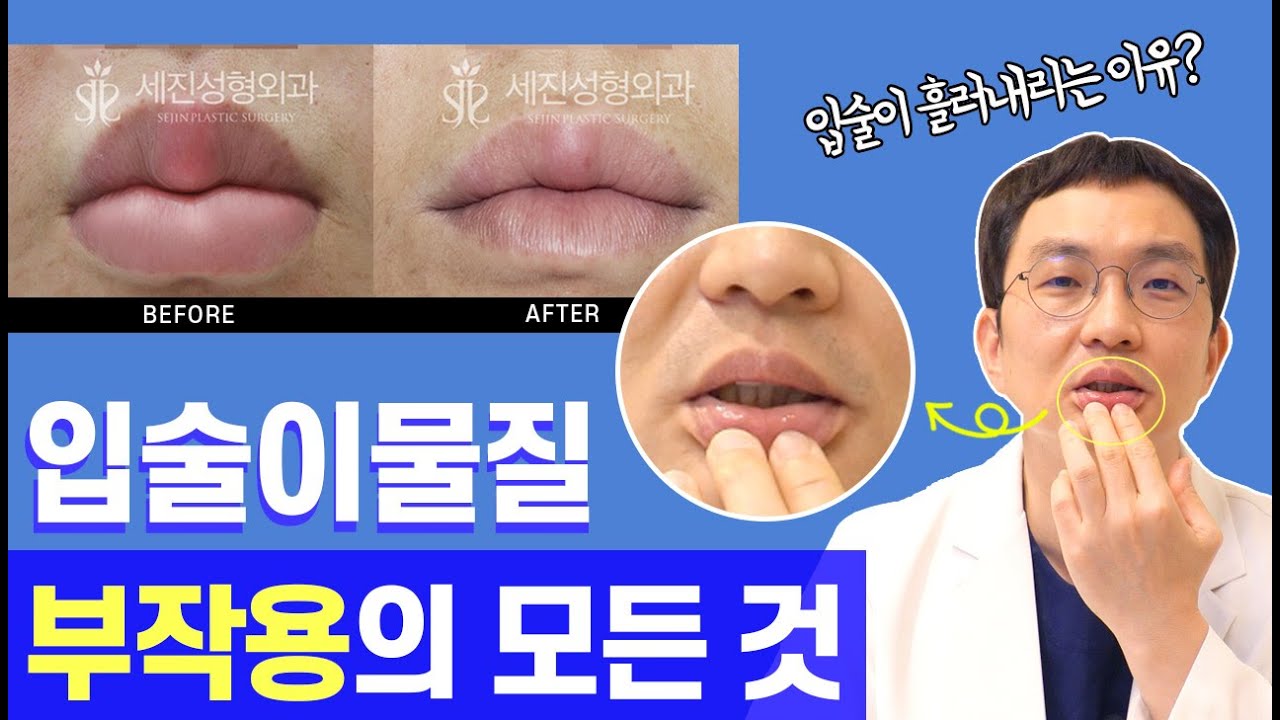 #입술이물질부작용 증상, 이물질제거방법! 입술이물질의 모든 것 알려드립니다!