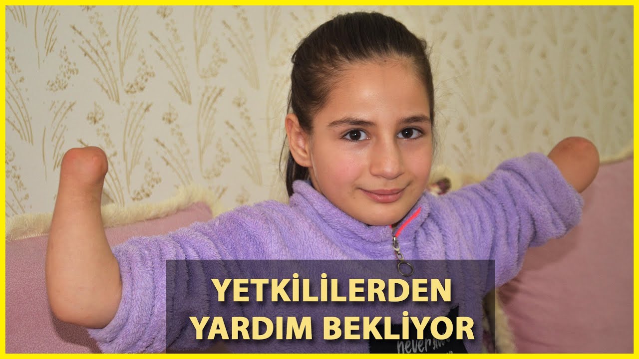 Küçük Rabia Protez El İstiyor