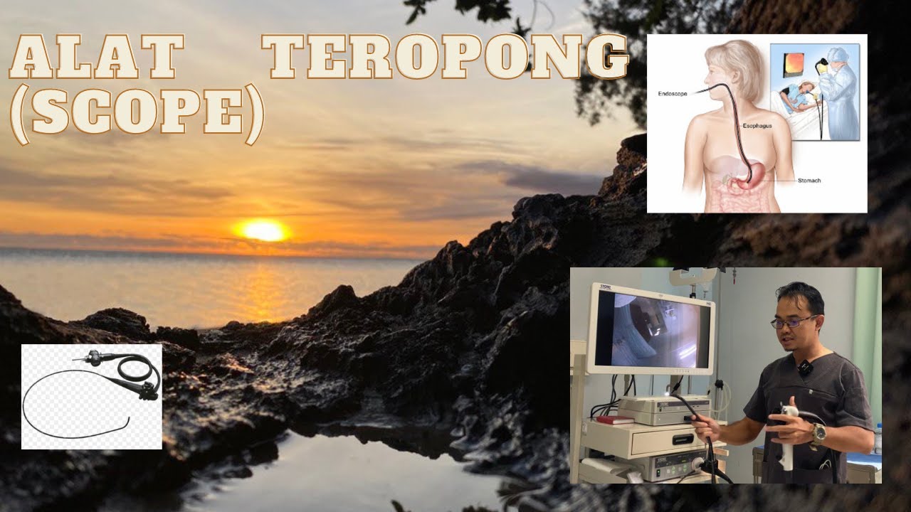 alat teropong (scope)