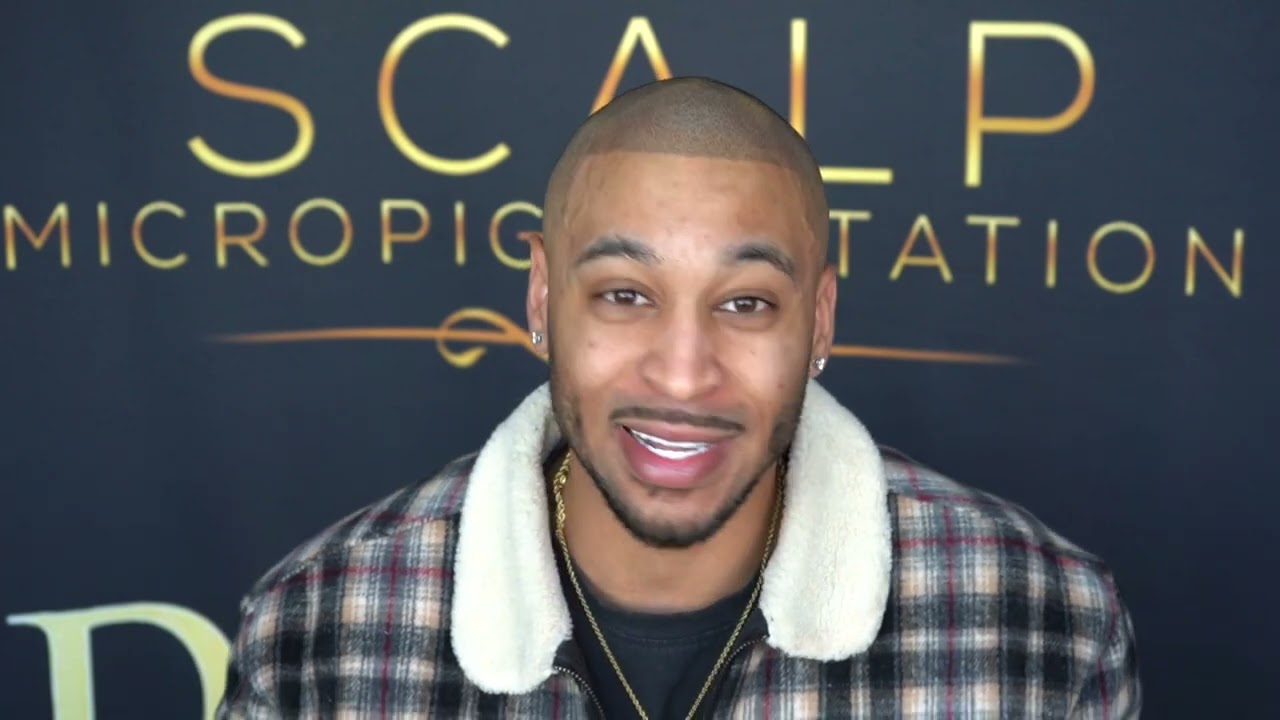 SMP Testimonial @THEARTOFSMP Scalp Micropigmentation review
