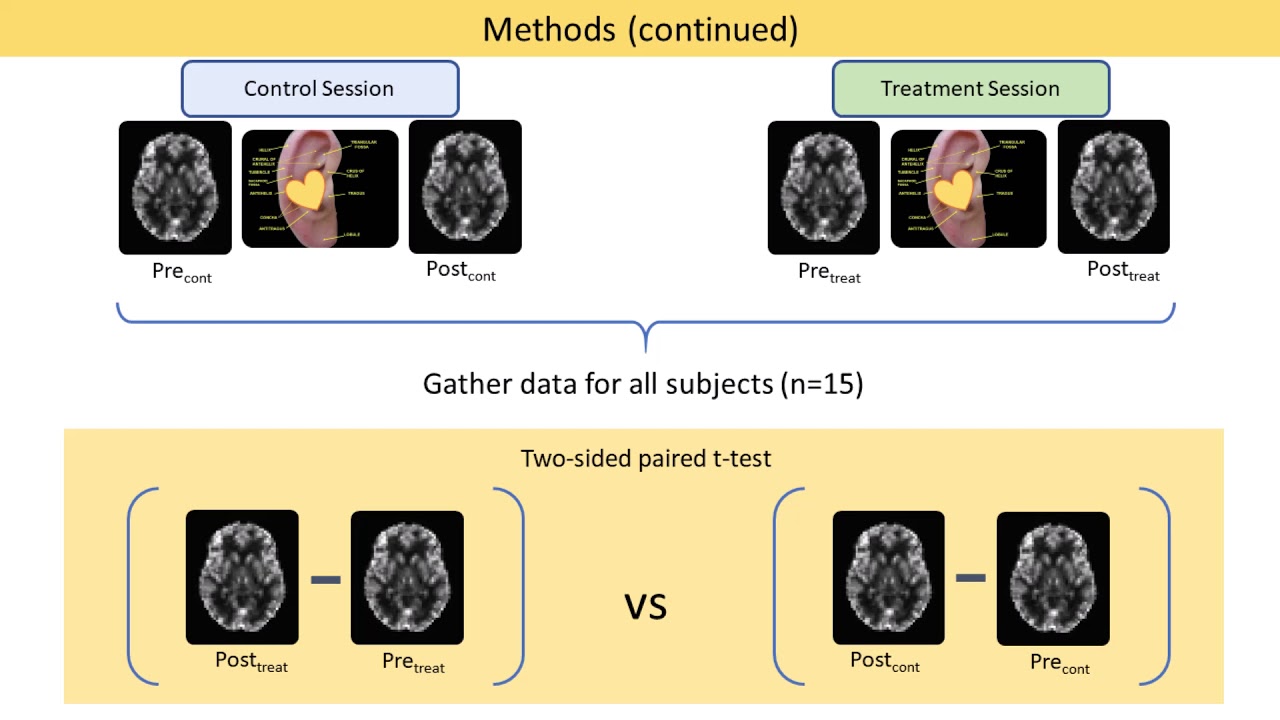 Effects of sub-threshold transcutaneous auricular vagus nerve stimulation on cerebral blood flow