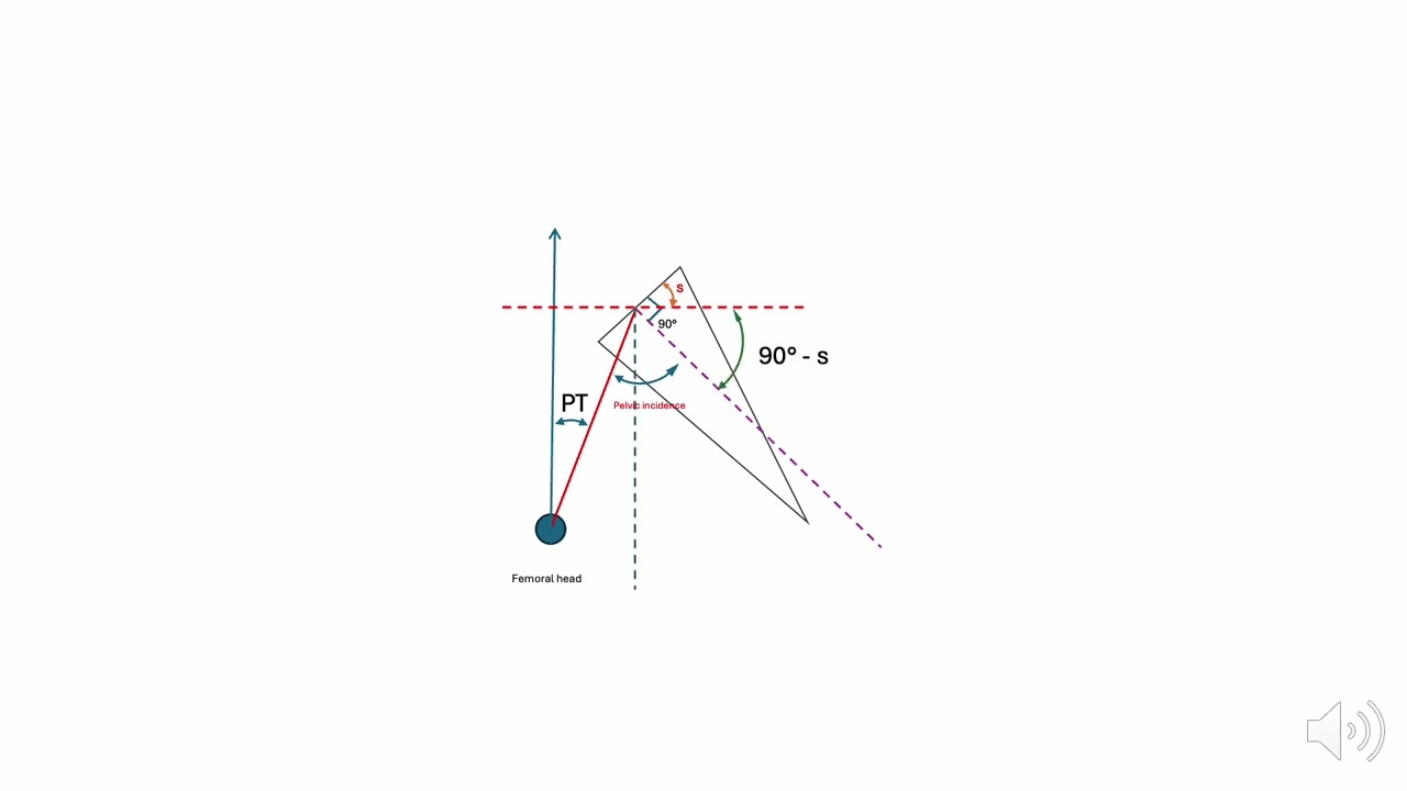 Pelvic Incidence, Pelvic tilt and Sacral slope: geometrical construction