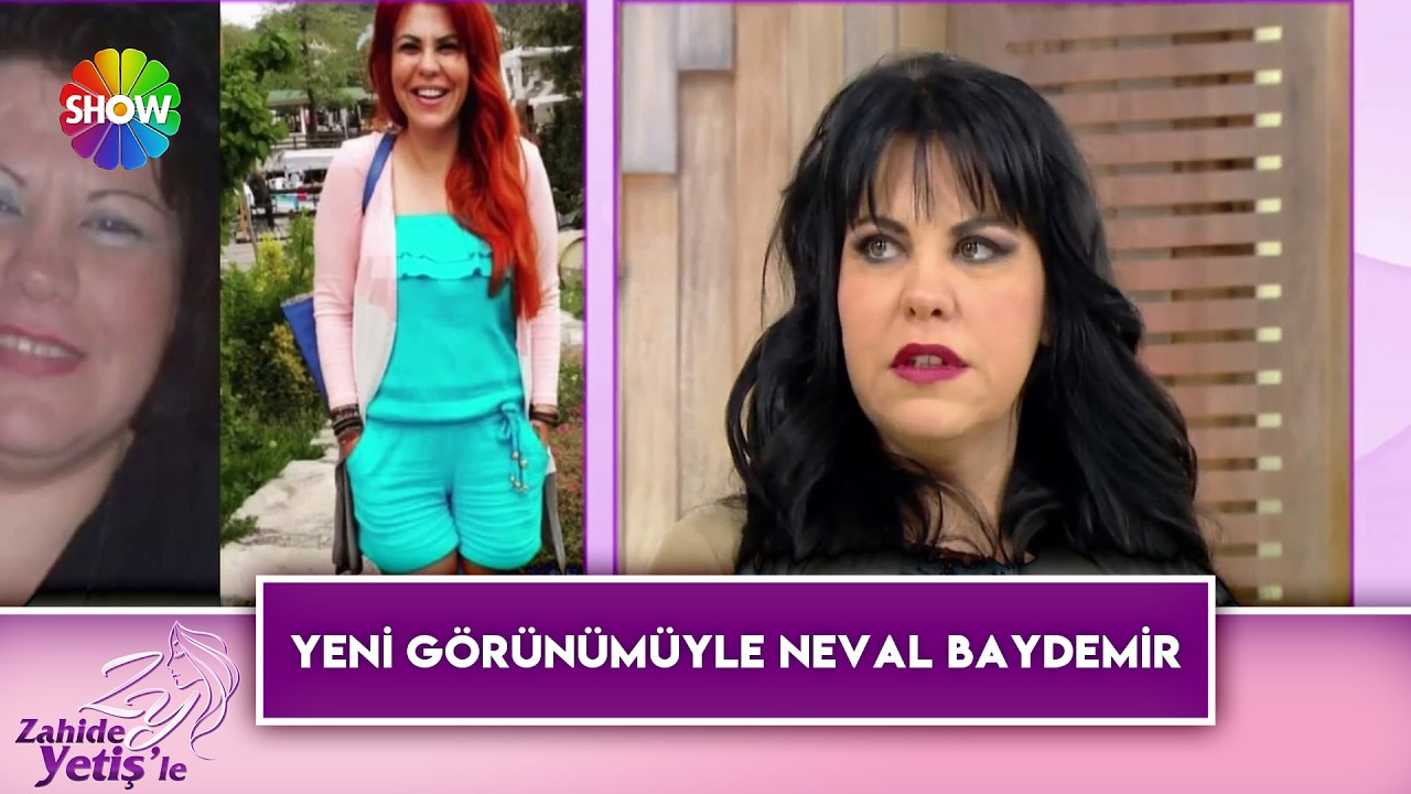 12 ayda 80 kilo vererek inanılmaz bir değişim yaşadı | Zahide Yetiş'le