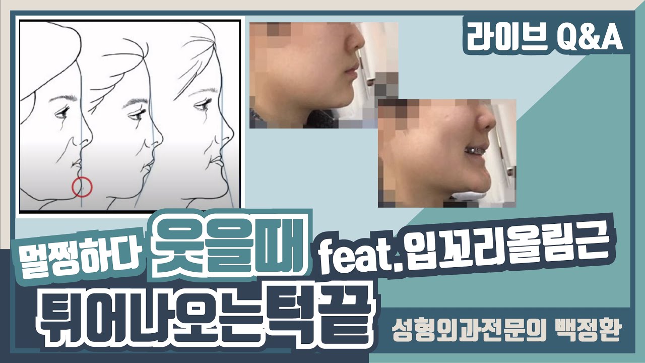 미소짓거나 웃을 때 턱끝이 튀어나와요...입꼬리 올림근, 내림근에 대해