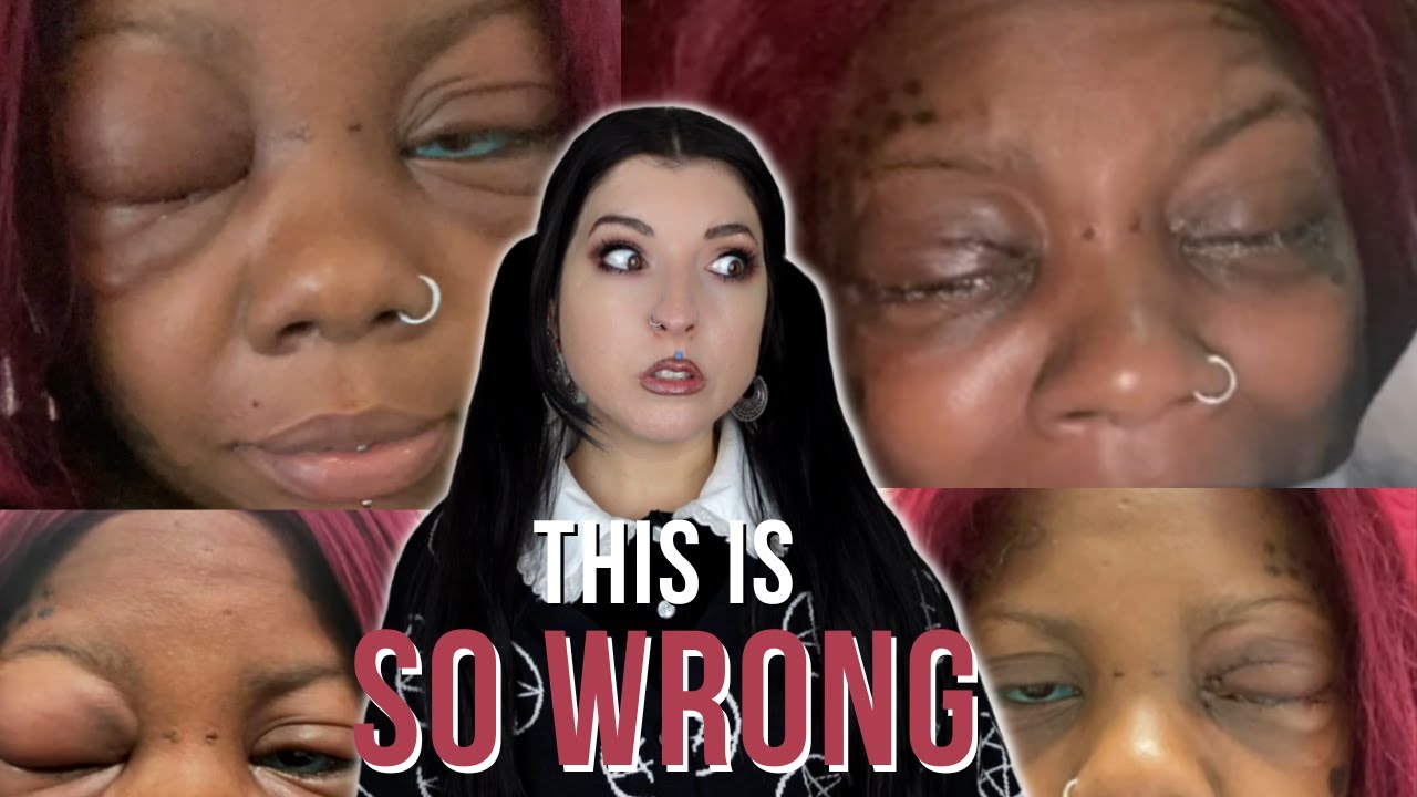 This Woman's Eyeball Tattoo Is MAKING HER GO BLIND