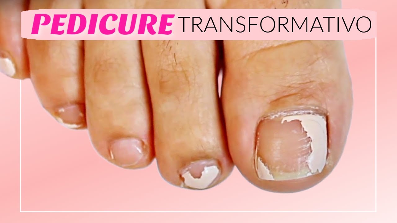 Pedicure TRANSFORMATIVO!! 😱❤️(Antes y Despues)