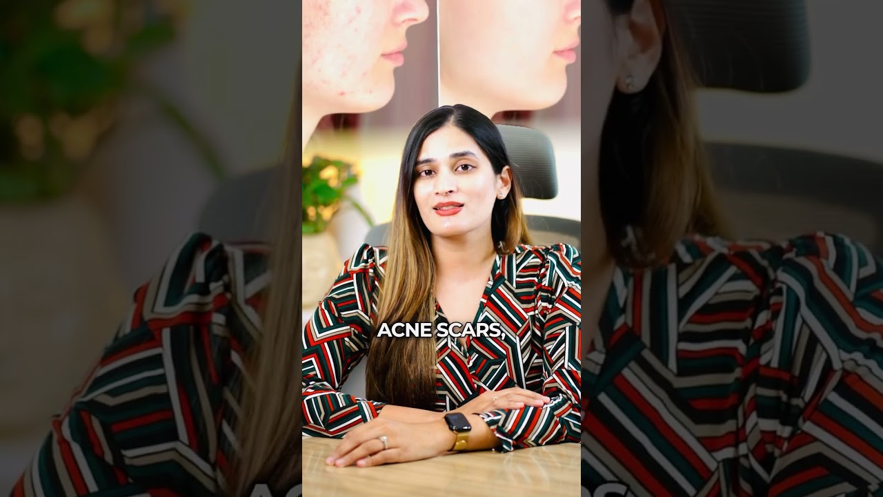 ARE VAMPIRE FACIALS SAFE? KNOW THE TRUTH WITH DR MANISHA MAREDDY | BEST DERMATOLOGIST IN GACHIBOWLI