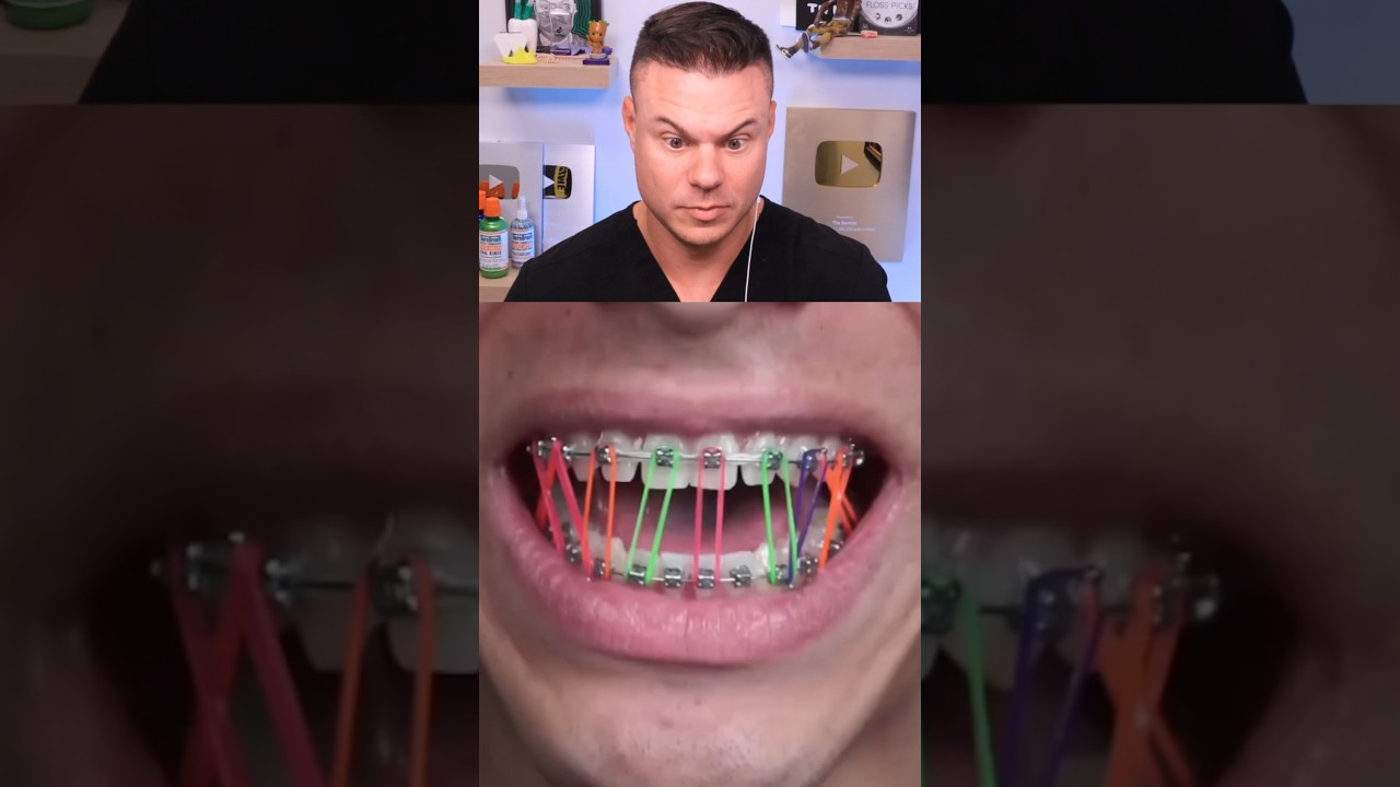 The Real Use Of Rubber Bands?!
