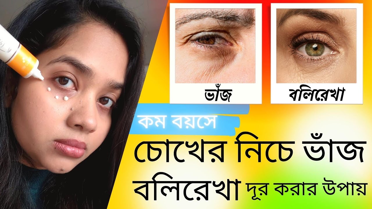 😀 কম বয়সে চোখের নিচে ভাঁজ ও বলিরেখা দূর করার উপায় । How To Remove Eye Wrinkles?