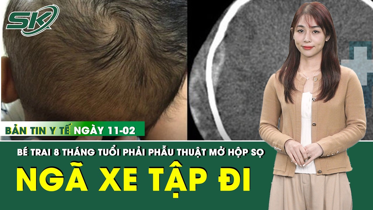 Bản Tin Y Tế 11/2: Chỉ từ một cú ngã nhẹ khi tập đi bằng xe tròn, bé trai 8 tháng tuổi nguy kịch
