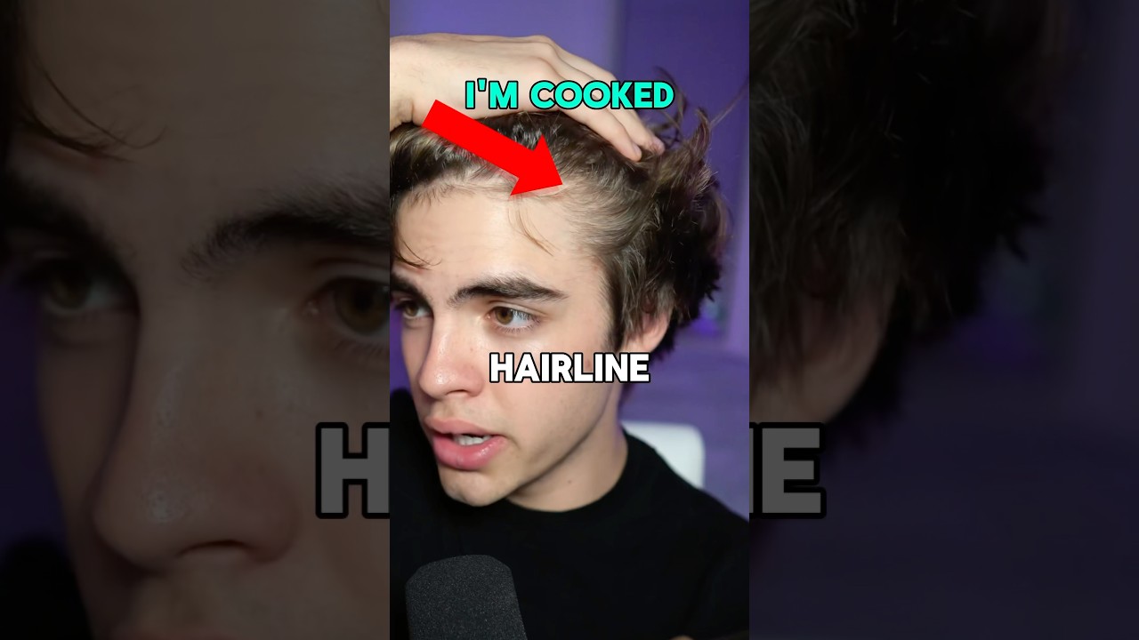 3 signs that you&rsquo;re going bald 😱