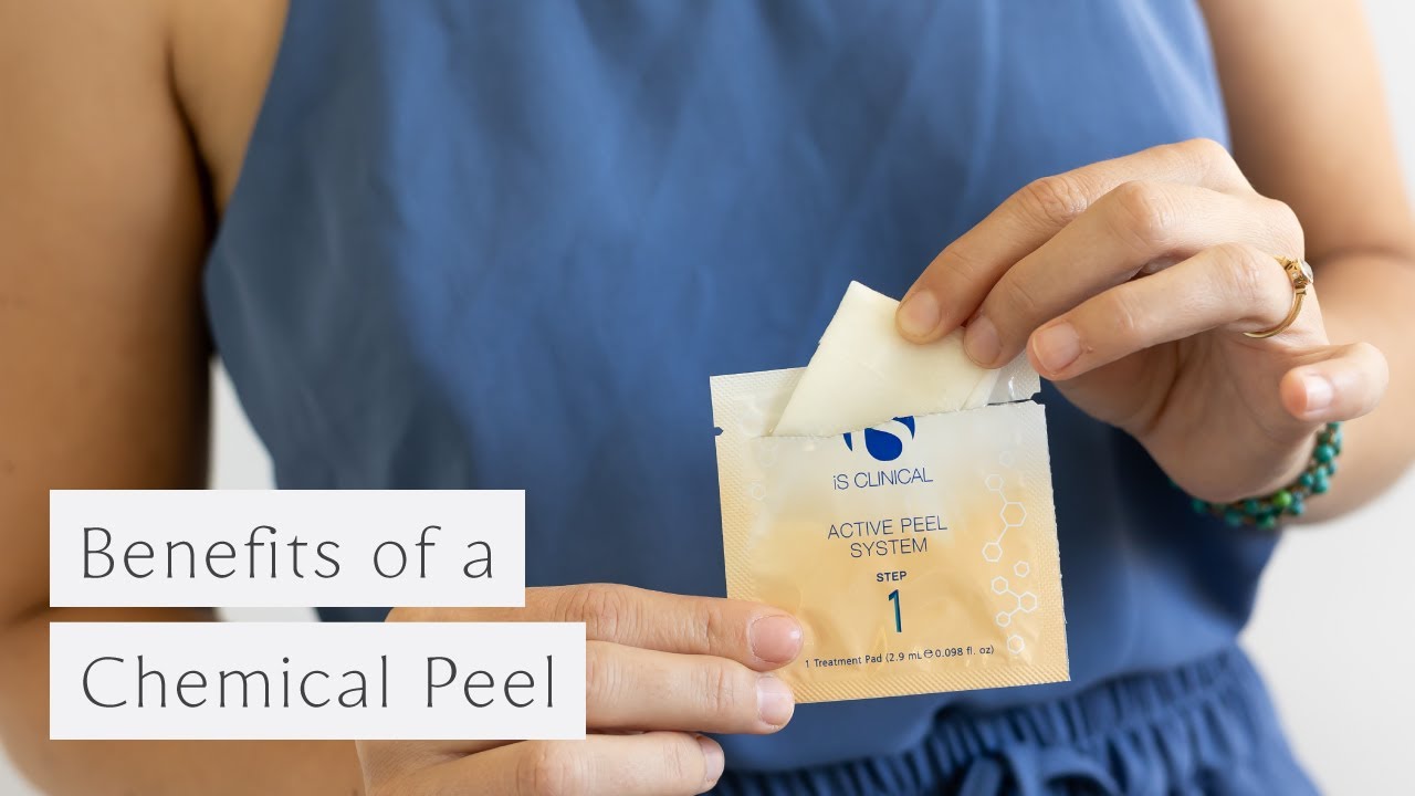 The Benefits of A Chemical Peel