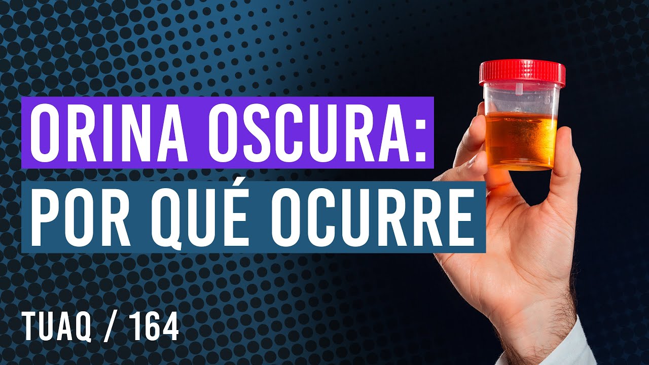 #Orina Oscura por qu&eacute; ocurre #orinaoscura #color orina