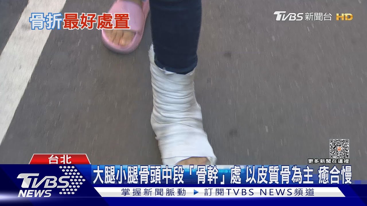 不慎發生骨折....多久才會好? 醫師: 「兩大指標」是關鍵 勿輕忽!｜十點不一樣20230518@TVBSNEWS02