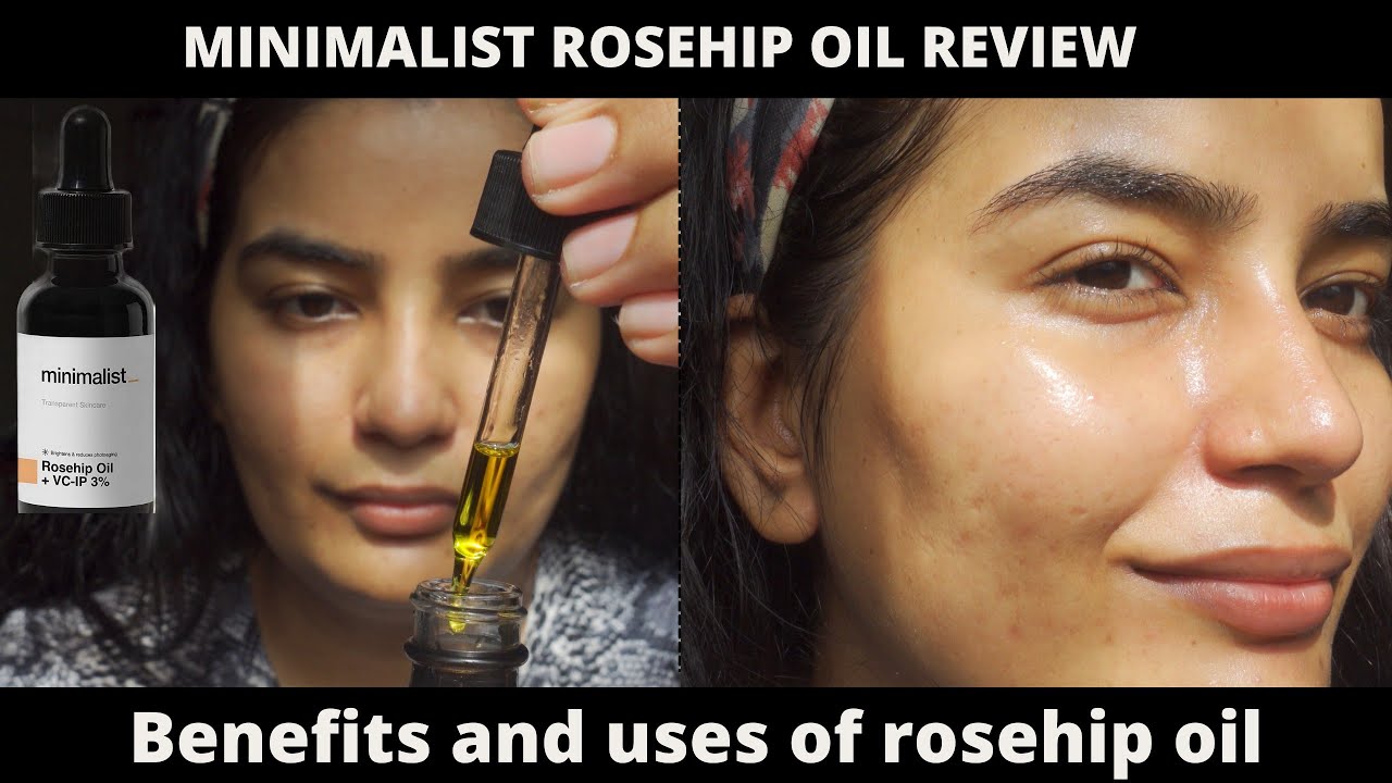 Minimalist rosehip oil + VC IP-3% review | Benefits and Ways to use on face and body