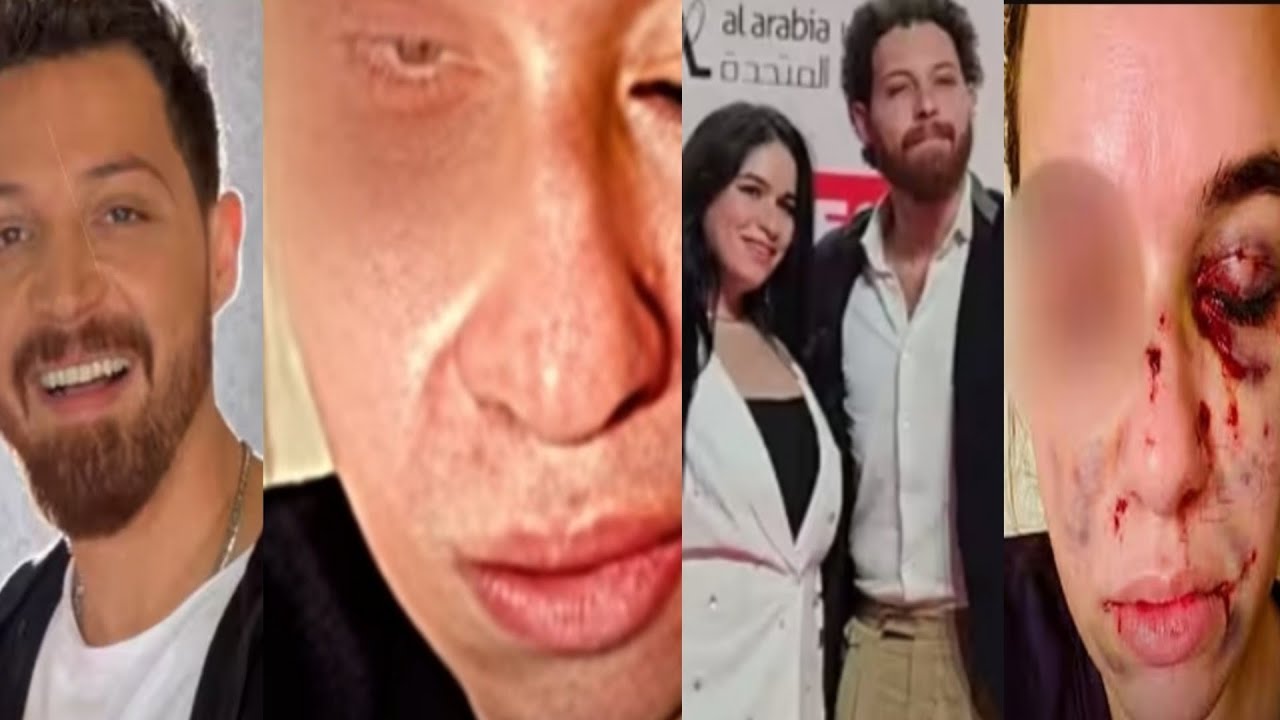 @ محمود حجازي كاميرات المراقبة القبض عليه بعد التقرير الطبى لزوجته منع إبنه من السفر لأمريكا تفاصيل 