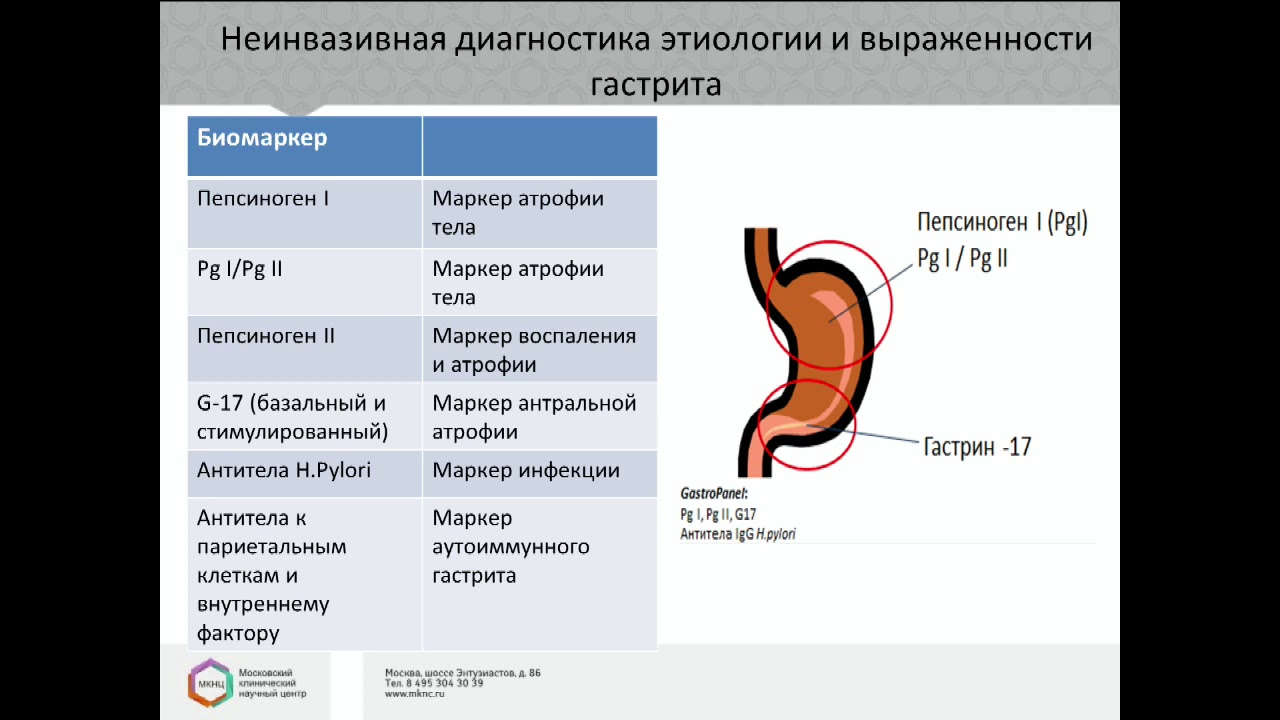 Круглый стол «Атрофический гастрит, МАLT-лимфома и НЭО желудка – междисциплинарный подход»