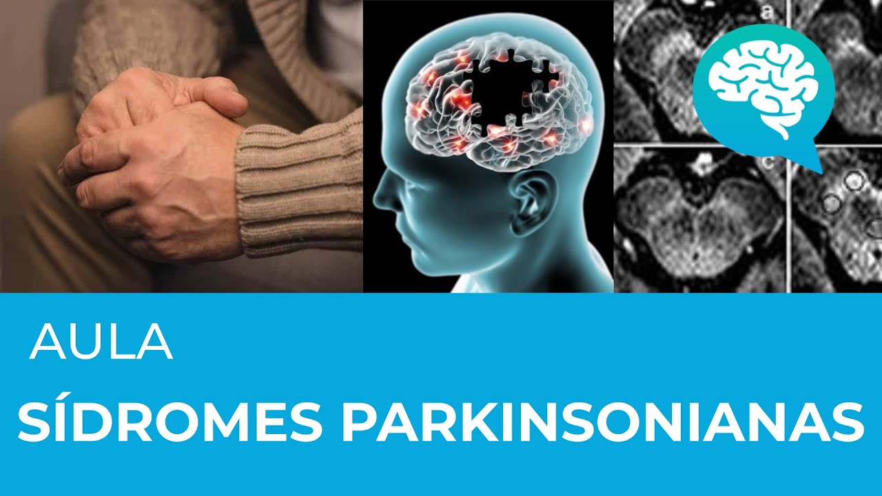 SÍNDROMES PARKINSONIANAS | AULA | DRA LARA BRANDÃO E DRA DENISE NICARETTA