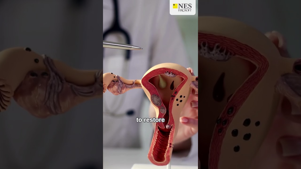 An Anti-Malarial Drug Could Help With PCOS Symptoms 💊 #EngineeringNews