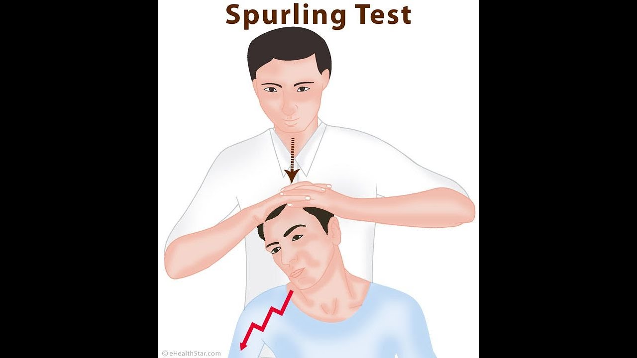 Spurling Test