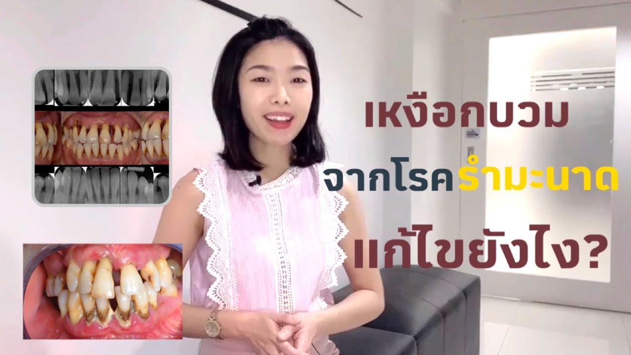 เหงือกบวมจากโรครำมะนาด แก้ไขยังไง?