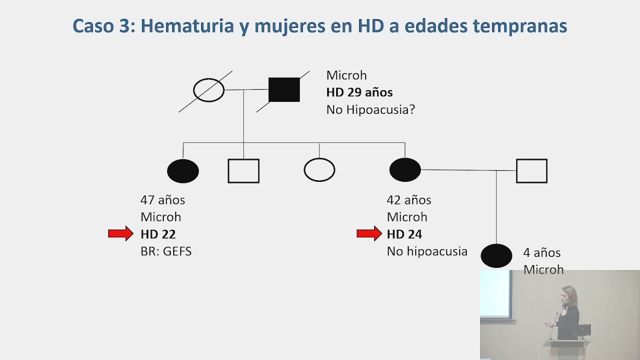 Aspectos prácticos en la Enfermedad de Alport