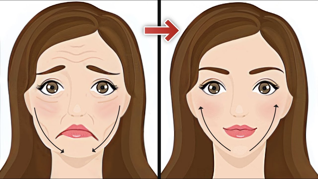 Face lifting exercises for jowls and smile lines (10 mins, Super easy)