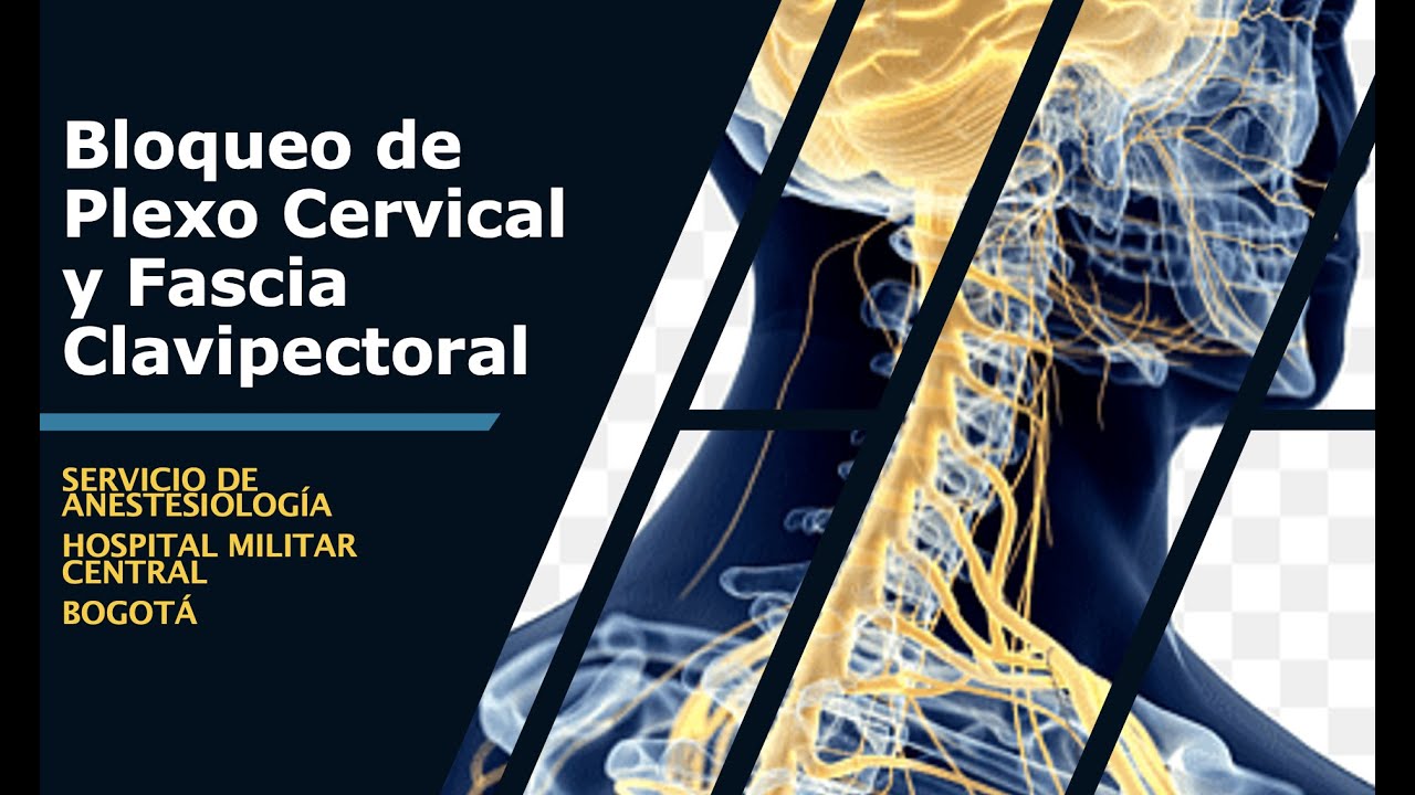 BLOQUEOS DE PLEXO CERVICAL Y FASCIA CLAVIPECTORAL