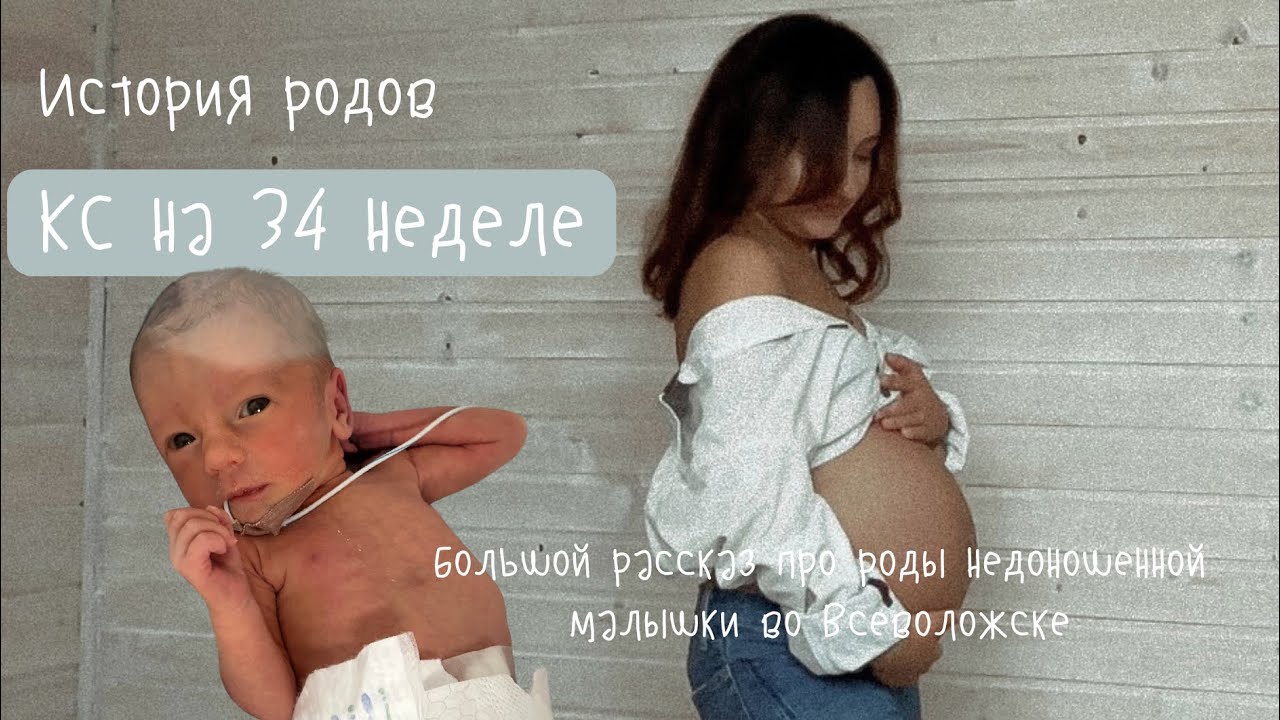 ИСТОРИЯ РОДОВ 🤰🏽 Кесарево сечение на 34 неделе. Недоношенный ребенок. Роддом г. Всеволожск