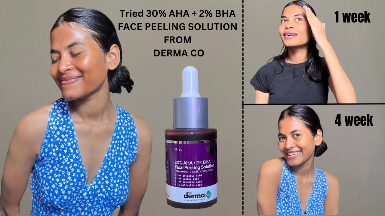 Trying Face Peeling Solution for 4weeks | 30%AHA + 2%BHA | #myskincareroutine #mylife