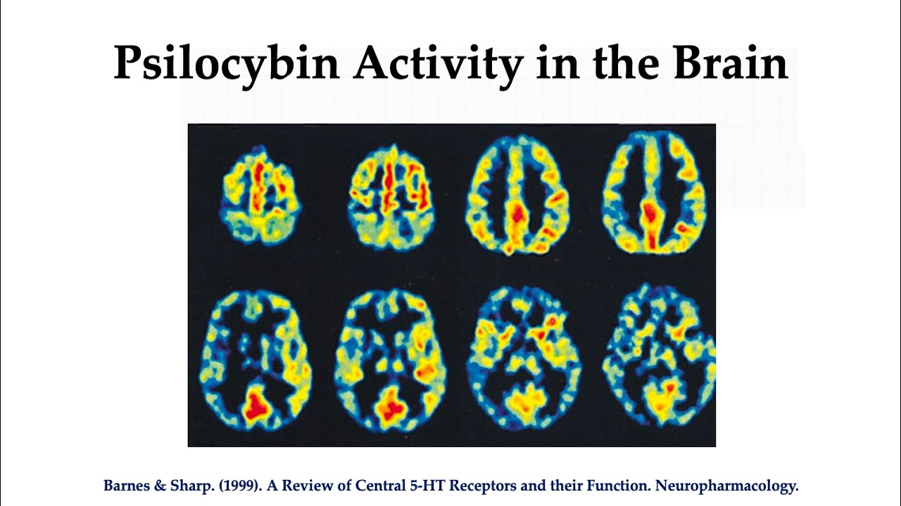 Brain Metabolism: Psilocybin, MDE, & Meth (Gouzoulis-Mayfrank et al., 1999)