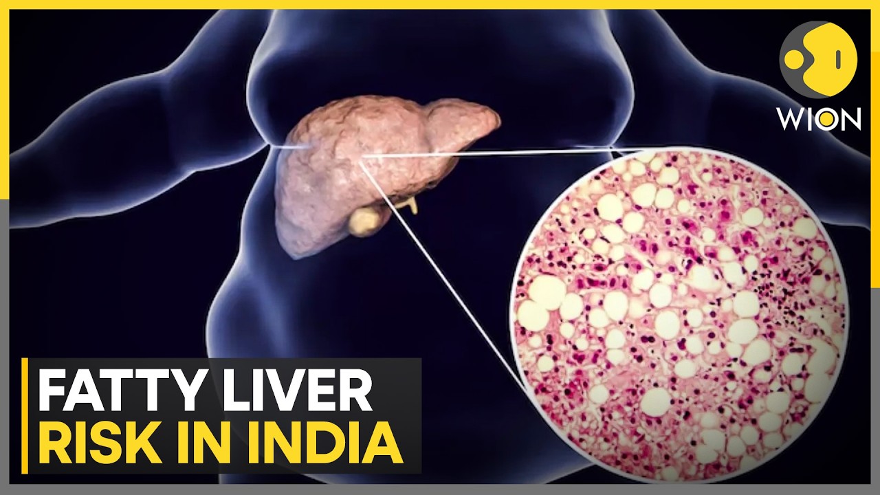 New Study Flags Heightened Risk of Liver Disease in India | WION News