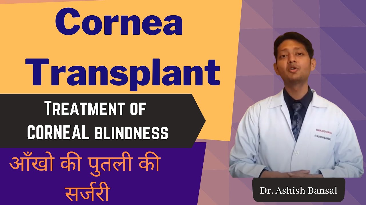 Cornea Transplant Eye Surgery Corneal Blindness treatment | आँखो की पुतली बदलने की सर्जरी